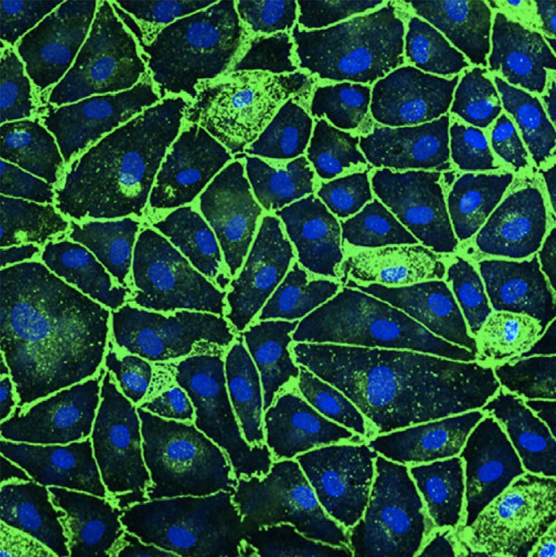 Neurons
