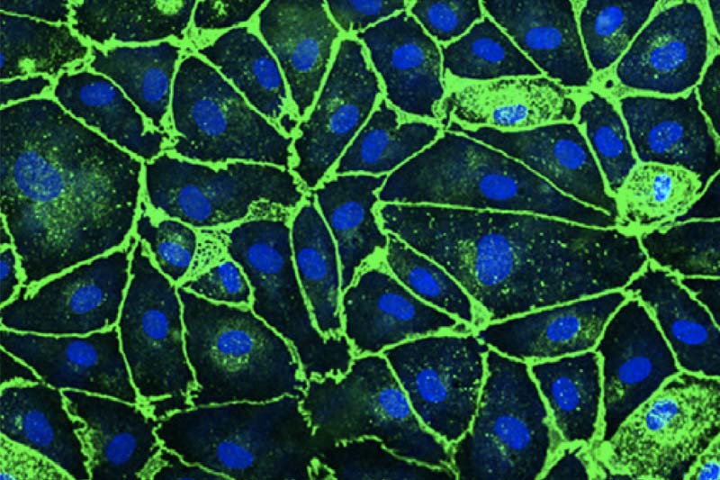 Neurons